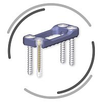Thoraco-lumbar arthrodesis plate CONTACTanterolateraltitanium