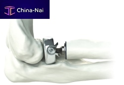 Radial head prosthesis ALIGN ®