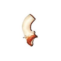 Ascending aorta vascular bioprosthesis CardioGraft®allograft