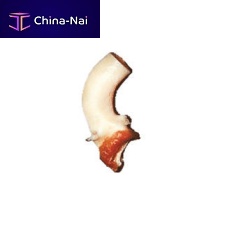 Ascending aorta vascular bioprosthesis CardioGraft®allograft