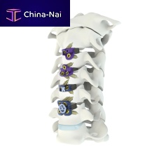 Cervical interbody fusion cage Mecta-C anteriortitanium