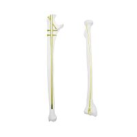 Radius intramedullary nail QML ulnaproximal fixationdistal fixation
