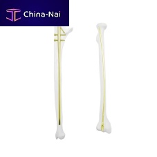 Radius intramedullary nail QML ulnaproximal fixationdistal fixation