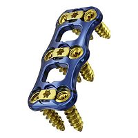 Cervical arthrodesis plate Admirallockingmetallic2 levels
