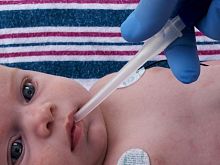 Nasal mucus suction cannula Little Sucker®pediatricneonatallatex