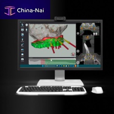 Medical software M3013D - MAGdentalfor guided surgerydesign