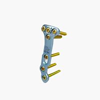 Tibia osteotomy plate TopFixproximallockingmetallic