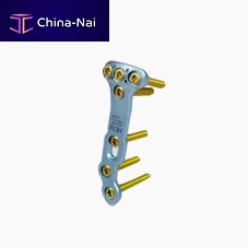 Tibia osteotomy plate TopFixproximallockingmetallic