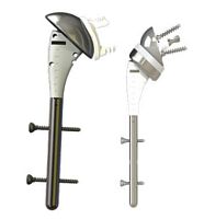 Revision shoulder prosthesis ARAMIS-Tcemented or non-cemented