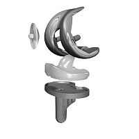 Total knee prosthesis FHK®fixed-bearingcemented or non-cemented