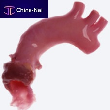 Aorta vascular bioprosthesis CryoValve®allograftwith valve