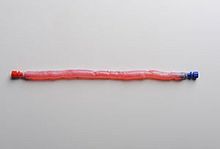 Femoral vein vascular bioprosthesis CryoVein® allograft