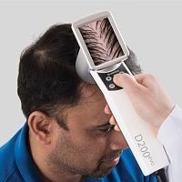 Video trichoscope HairMetrix®computer-based