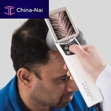 Video trichoscope HairMetrix®computer-based