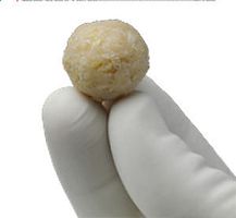 Allograft bone substitute ViviGen® for orthopedic surgerymalleable