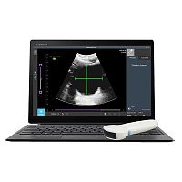 Hand-held ultrasound system RTBU-S-T for urology ultrasound imagingB/Wall-in-one probe