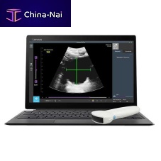 Hand-held ultrasound system RTBU-S-T for urology ultrasound imagingB/Wall-in-one probe