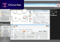 Gynecological examination software NEXUS / OBSTETRICSfor obstetric examinationsmanagement