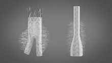 Abdominal aorta vascular prosthesis KARDIOZISsynthetic