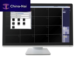 Dental display 22AM+1920 x 108022"DisplayPort