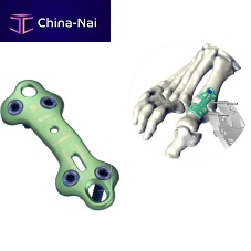 Forefoot arthrodesis plate UltOSfoot phalangelockingnon-locking