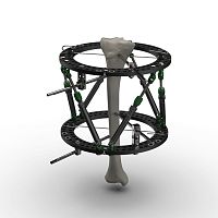 Modular external fixation system Spider Frame® circularadultpediatric
