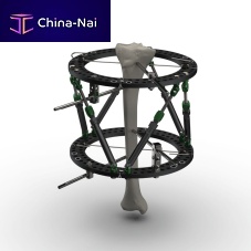Modular external fixation system Spider Frame® circularadultpediatric