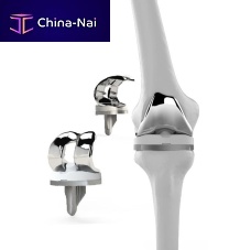 Total knee prosthesis 7513sliding, posterior stabilizedfixed-bearingcemented or non-cemented