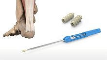 Calcaneal tendon suture anchor 46-0008-Stalo-calcaneal ligamentnon-absorbable