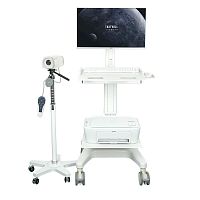 Video colposcope SY02trolley-mounted