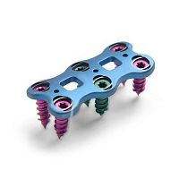 Cervical vertebra arthrodesis plate ATHENA® IIIlockingtitanium2 levels
