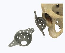 Acetabular reinforcement R.7582-00 series