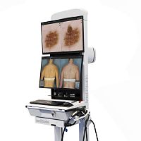 Video dermatoscope IntelliStudio3white LEDcomputer-based