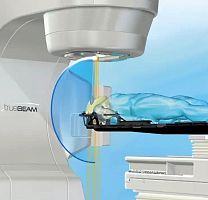 Stereotactic radiosurgery linear particle accelerator HyperArcwith robotized positioning tablewith multi-leaf collimator (MLC)