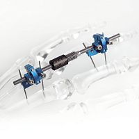 Metacarpophalangeal joint external fixation system FIXUS22metatarsophalangeal jointtubularadult