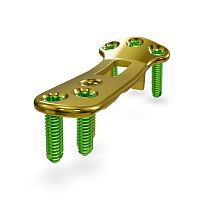 Tibia osteotomy plate 26.04.50.00303proximallockingtitanium