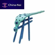 Ulna osteotomy plate olecranonproximallocking
