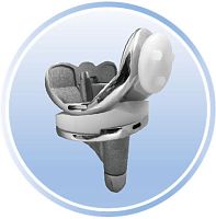 Total knee prosthesis XA mobile-bearingcementless