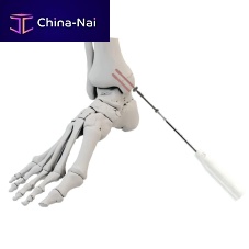 Malleolus arthrodesis screw cannulatedtitaniumcortical