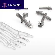Metatarsophalangeal joint compression bone screw ExtremiFuse metallic