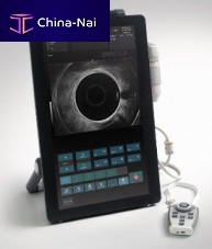 Portable ultrasound system ALBIT for urology ultrasound imagingB/Wtouchscreen