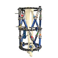 Tibia external fixation system Smart Correction® fibulahumeruscircular