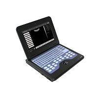 Portable ultrasound system CMS600P2 for gynecological and obstetric ultrasound imagingfor urology ultrasound imagingfor cardiovascular ultrasound imaging