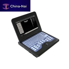 Portable ultrasound system CMS600P2 for gynecological and obstetric ultrasound imagingfor urology ultrasound imagingfor cardiovascular ultrasound imaging
