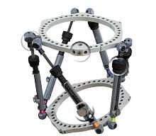 Tibia external fixation system femuranklecircular