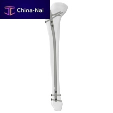 Tibial intramedullary nail 305014 seriesproximal fixationdistal fixationright