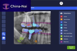 AI software dentalXrai Pro 3.0medicaldentalperiodontal