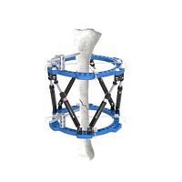 Tibia external fixation system anklecircularadult