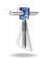 Lumbar pedicle screw Lora MISthoraciccannulatedmetallic