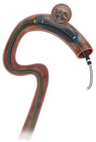 Occlusion catheter Scepter C®blood vesselballoonhydrophilic